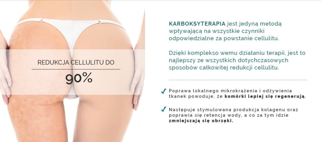 Karboksyterapia Julie Neoderma Salon Firmowy Warszawa